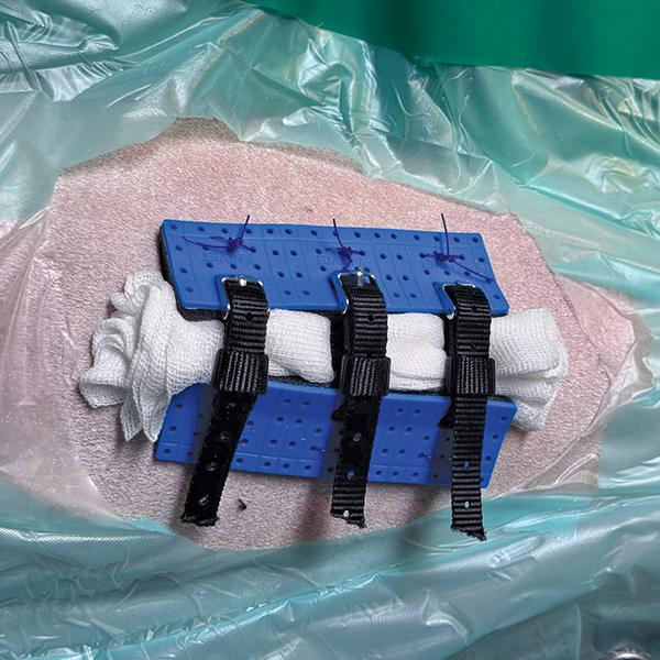 AniVet® Wundfix System - Image 4